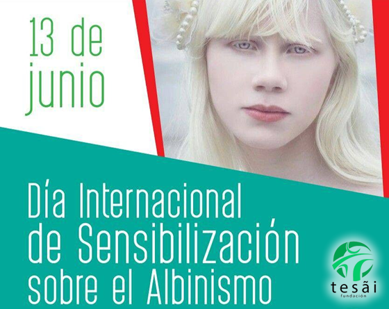 FundaciÓn TesÃi Día Mundial De Sensibilización Sobre El Albinismo Fundación Tesãi 7786